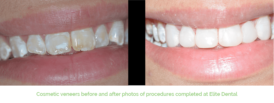 Cosmetic Dentistry west ryde